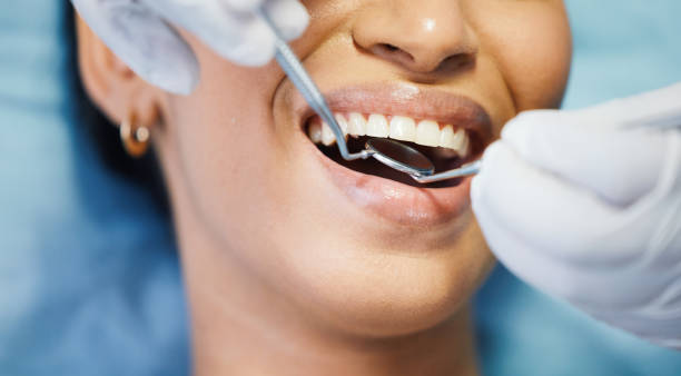 Best Emergency Broken Tooth Repair in Harkers Island, NC