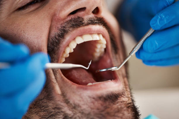 Best Walk-In Emergency Dentist in Harkers Island, NC