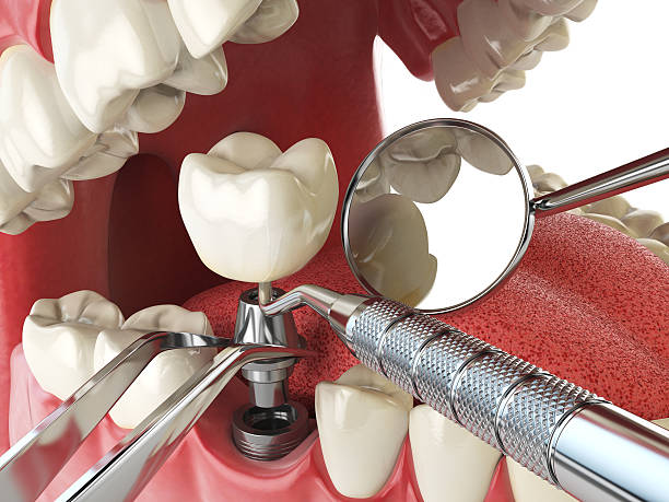 Best Emergency Dental Surgery in Harkers Island, NC